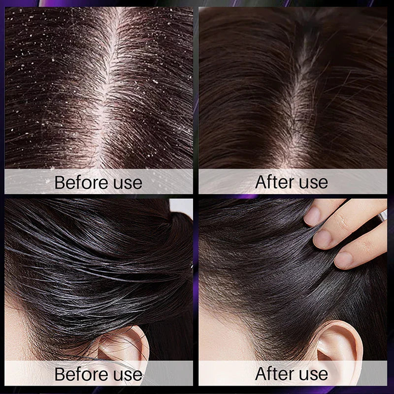 Hair Growth Thickening Shampoo with Rosemary Onion-2